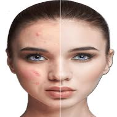 Pigmentation treatment In Nashik