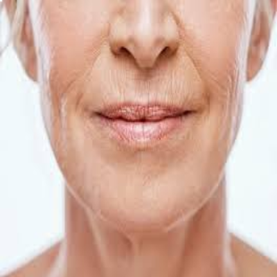 Pigmentation treatment In Nashik